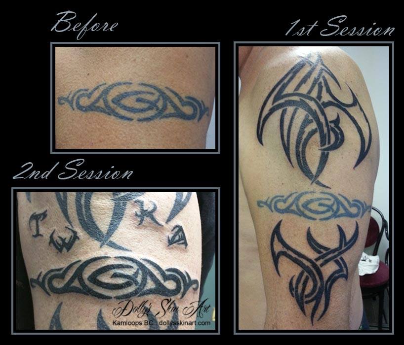 tony tribal arm tattoo rejuvenation