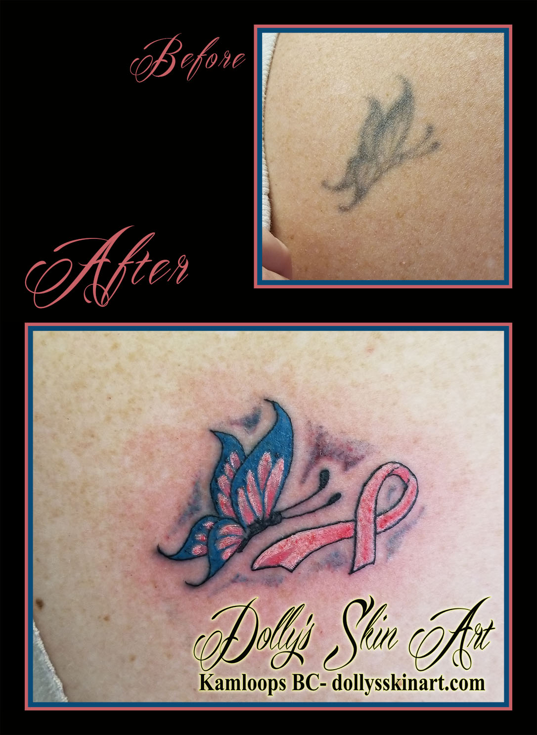butterfly breast cancer ribbon cover up refresh renew rejuvenate blue pink black white tattoo kamloops dolly's skin art